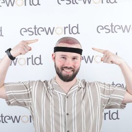 Niels, maak je geen zorgen wat mensen na de haartransplantatie zeggen