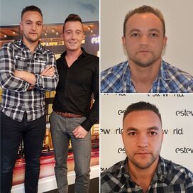 Yve, Goedkope haartransplantatie Turkije