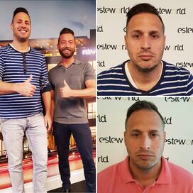 Haartransplantatie ziet er keurig uit, ben er echt blij mee!