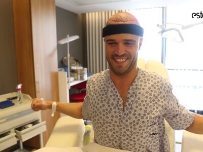 Forum over haartransplantatie