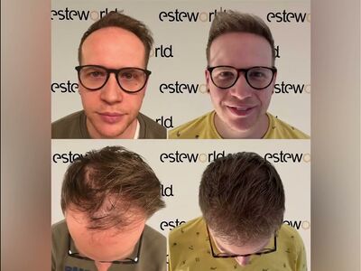 Voelde als vakantie door de goede zorg