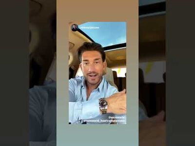 @niekmarijnissen baardtransplantatie bij Esteworld