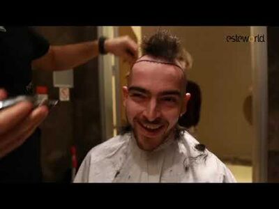 Een haartransplantatie spookte al zo lang door mijn hoofd