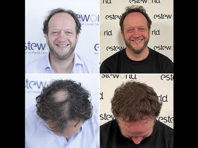 Acteur Rein Hofman, ik wist dat deze dag ging komen