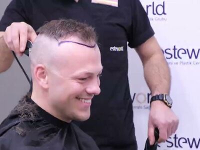 Haartransplantatie Turkije kosten