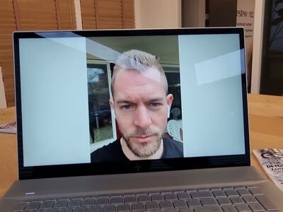 Consult bij Esteworld Haartransplantatie