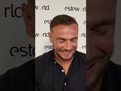 Baard/haartransplantatie voor Joris