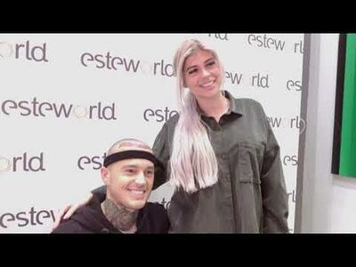  Davey Schniermanni voor haartransplantatie bij Esteworld