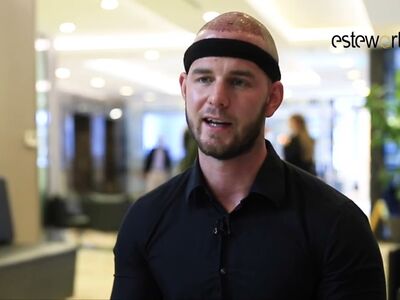 Kosten haartransplanstatie in Turkije