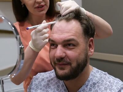 Joeri, zoals veel mannen begon ik kaal te worden