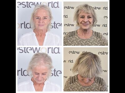 Will, Eerste Haartransplantatie in NL niet goed, nu 2e kans