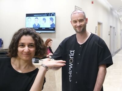 Jorrit stoorde zich al jaren aan die terugtrekkende haarlijn