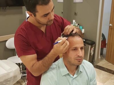 Haartransplantatie ziet er keurig uit, ben er echt blij mee!