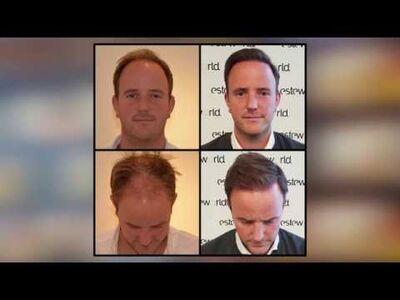 Kan Esteworld iedereen aanraden.Gewoon doen!