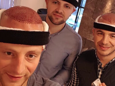 Bram, ik word kaal, hier wilde ik wat aan laten doen!