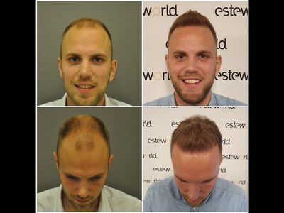 Arno, kaal, kammen of….Esteworld?
