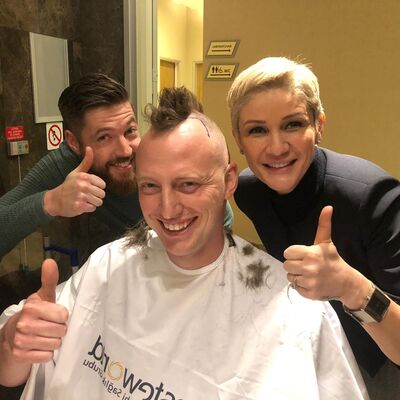 Altijd last gehad van een hoog voorhoofd