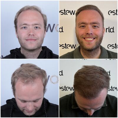 Nieck, De nazorg van Esteworld is fantastisch. 24/7 kan je terecht.