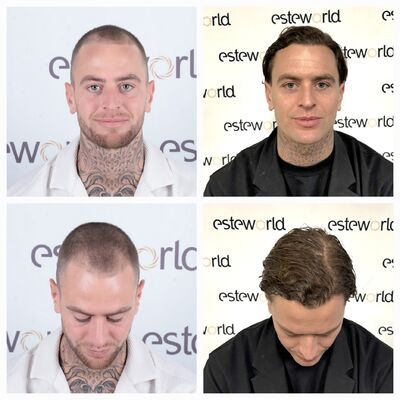 DJ Boray (sickeau) niks om je zorgen over te maken