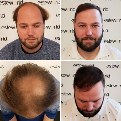 Ik wil de keuze hebben om mijn haar kort te scheren!