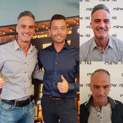 Dank voor de goede haartransplantatie, uitleg en zoveel meer. Jullie waren top!