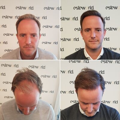 Kan Esteworld iedereen aanraden.Gewoon doen!