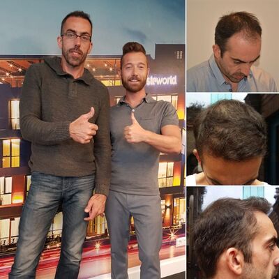 Kurt, zit haarverlies dermate negatief “in uw hoofd”, aarzel dan niet!