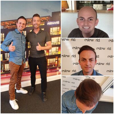 Jan Simons, met mijn haar het zelfvertrouwen terug! 