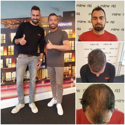 Wim, al jaren stoorde ik mezelf aan mijn inhammen en dunne haren!