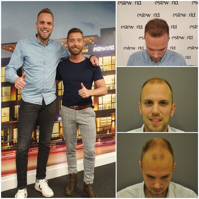 Arno, kaal, kammen of….Esteworld?