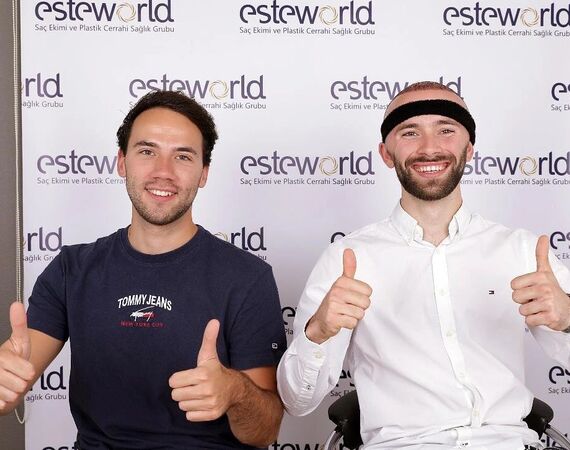 Advies over haartransplantaties op haarweb