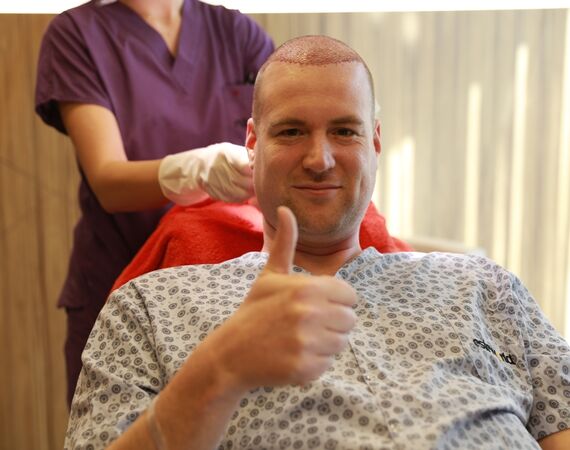Haartransplantatie voor Studenten