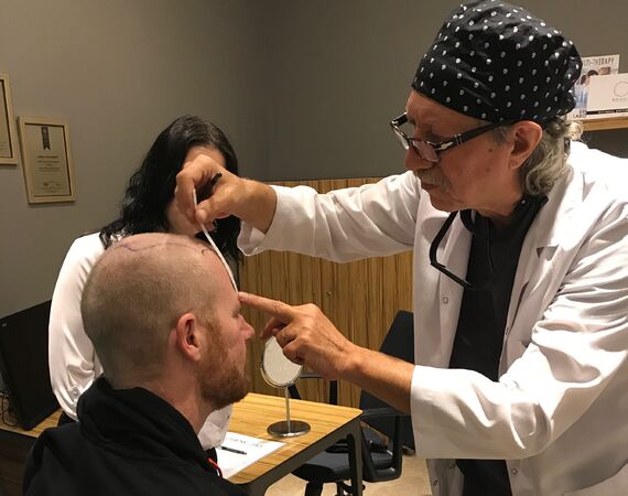 Haartransplantatie klinieken vergelijken in Turkije