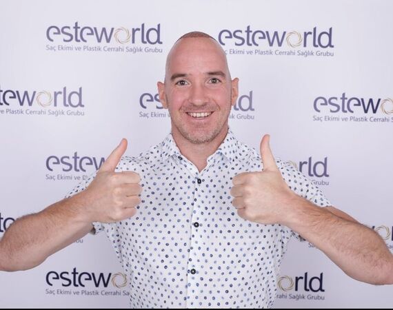 Consult bij Esteworld Haartransplantatie