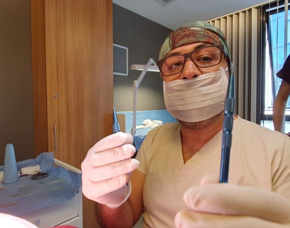 FUE Saffier haartransplantatie