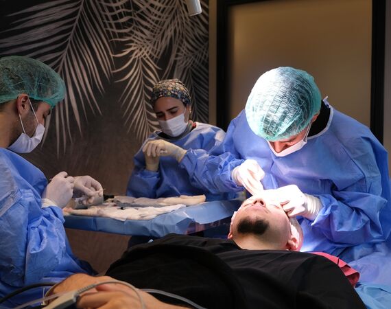 DHI haartransplantatie methode