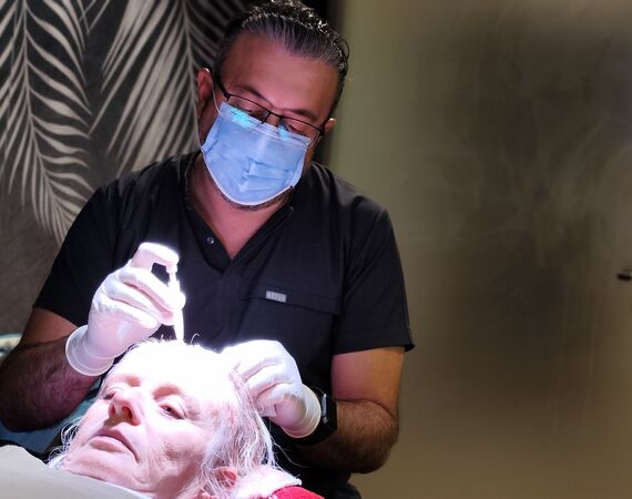 Haartransplantaties zonder scheren en de Long Hair methode