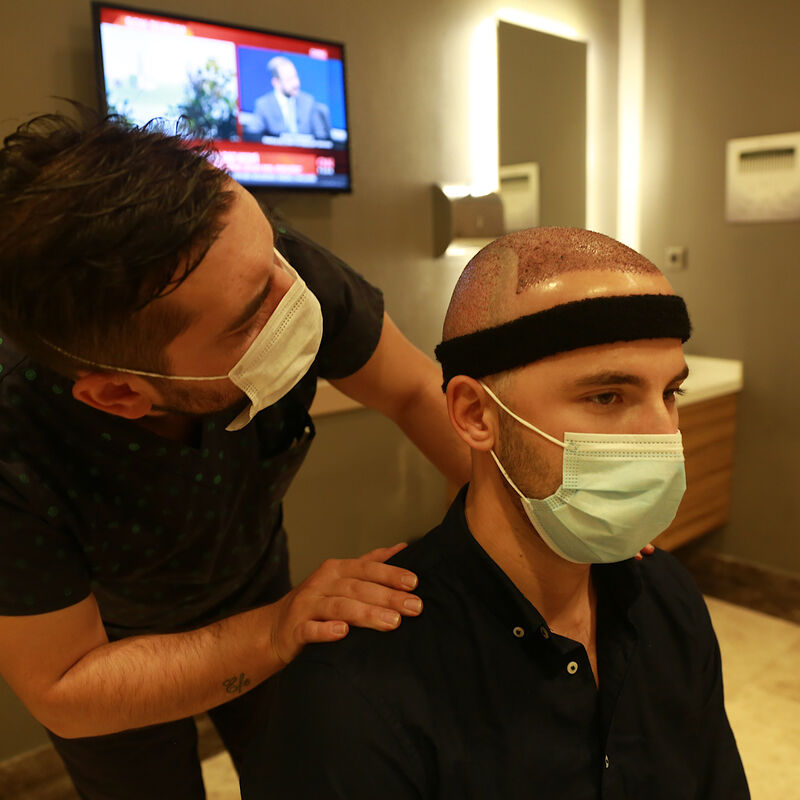 Jelmer, 100% vertrouwen in haartransplantatie resultaat