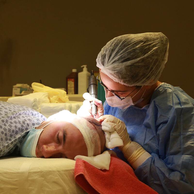 Jelmer, 100% vertrouwen in haartransplantatie resultaat