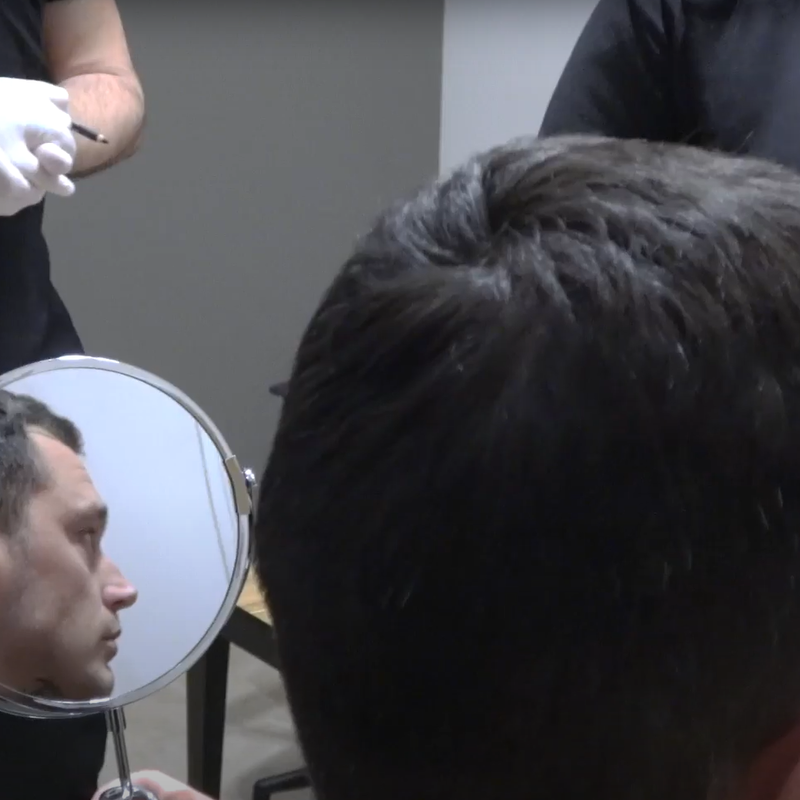 Davey Schiermanni: Ik wilde een lagere haarlijn