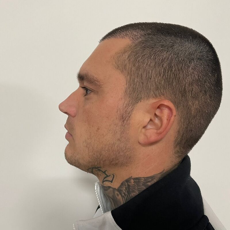 Davey Schiermanni: Ik wilde een lagere haarlijn
