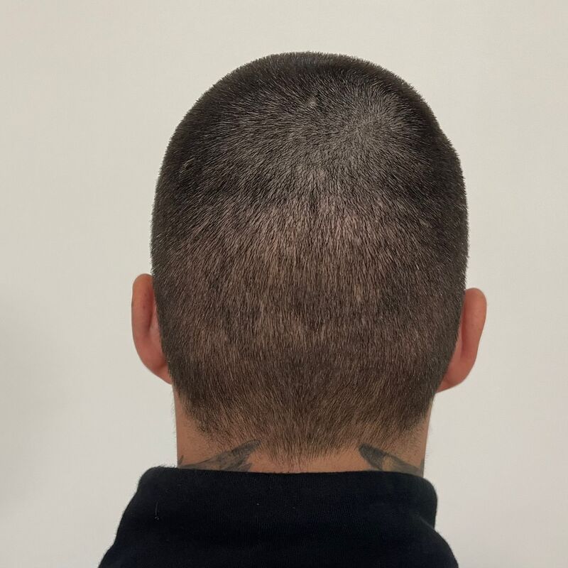 Davey Schiermanni: Ik wilde een lagere haarlijn