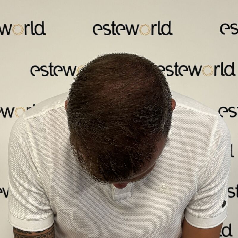 Esteworld hielp mij over de drempel