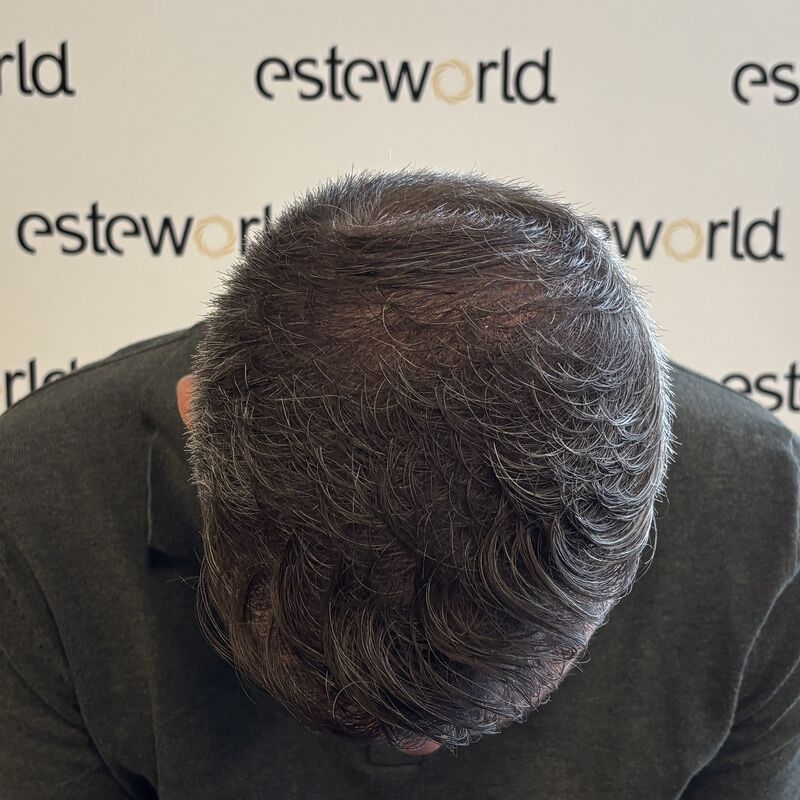 Esteworld hielp mij over de drempel