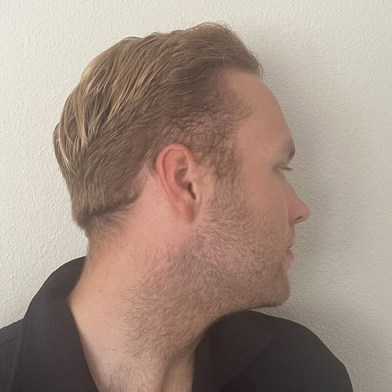Nieck, De nazorg van Esteworld is fantastisch. 24/7 kan je terecht.