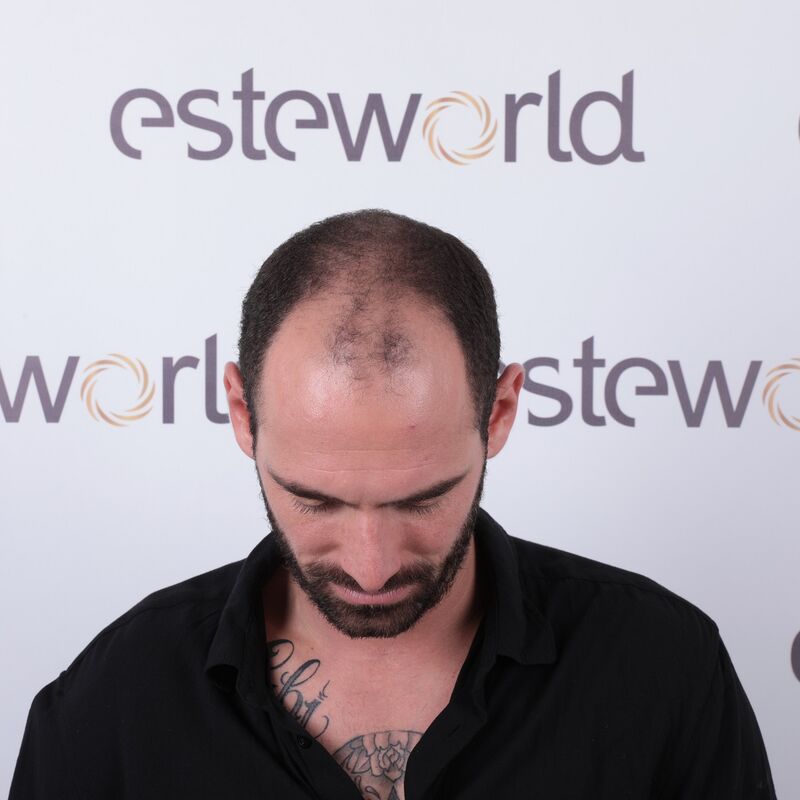 Max Vespucci van First Dates, ik werd rap kaal