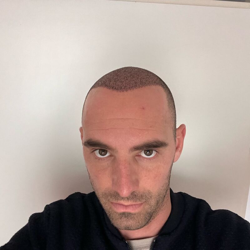 Max Vespucci van First Dates, ik werd rap kaal