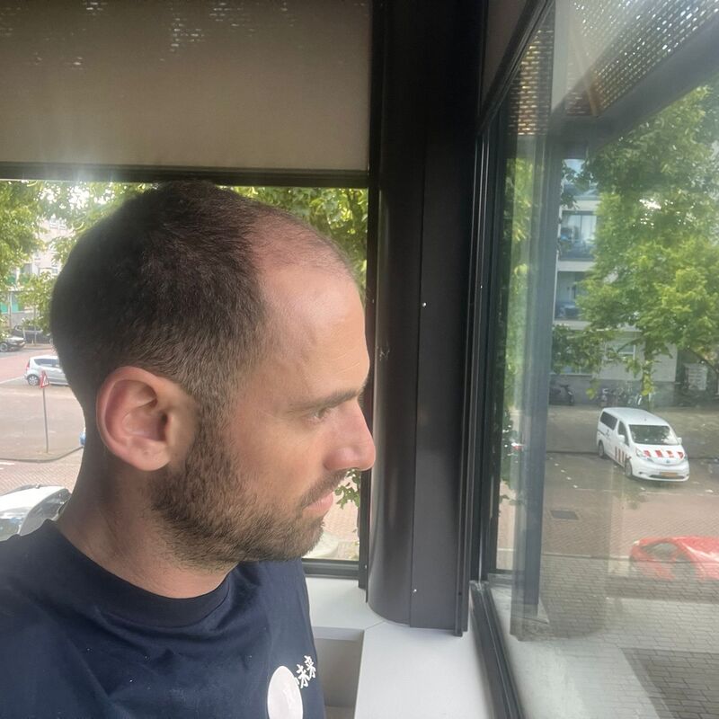 Max Vespucci van First Dates, ik werd rap kaal