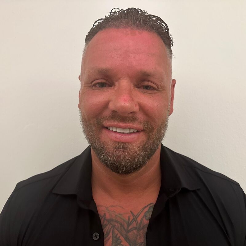 Micheal van der Plas baard en herstel haartransplantatie