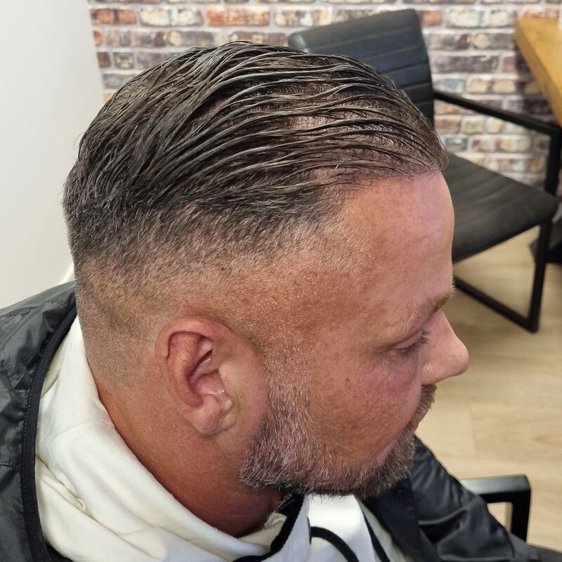 Micheal van der Plas baard en herstel haartransplantatie